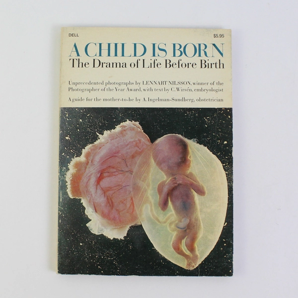A Child Is Born The Drama Of Life Before Birth In Unprecedented Photos 1975 PB