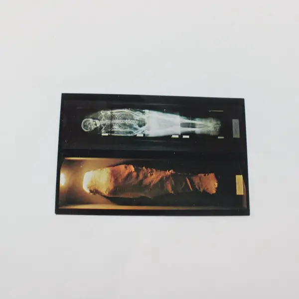 Vintage Museum of Science Natural History St Louis Mummy X-Ray Postcard